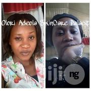 Lightening And Whitening Creams. | Skin Care for sale in Surulere